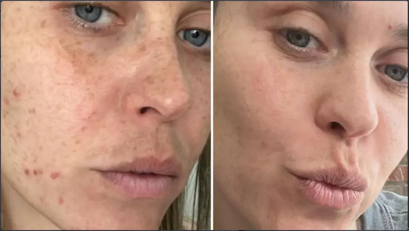 Centella Serum Nourish Improvement Dry Skin Smoothing Tightening Brightening Moisturizing Hyaluronic Acid Face Essence Skin Care Pi-Mart