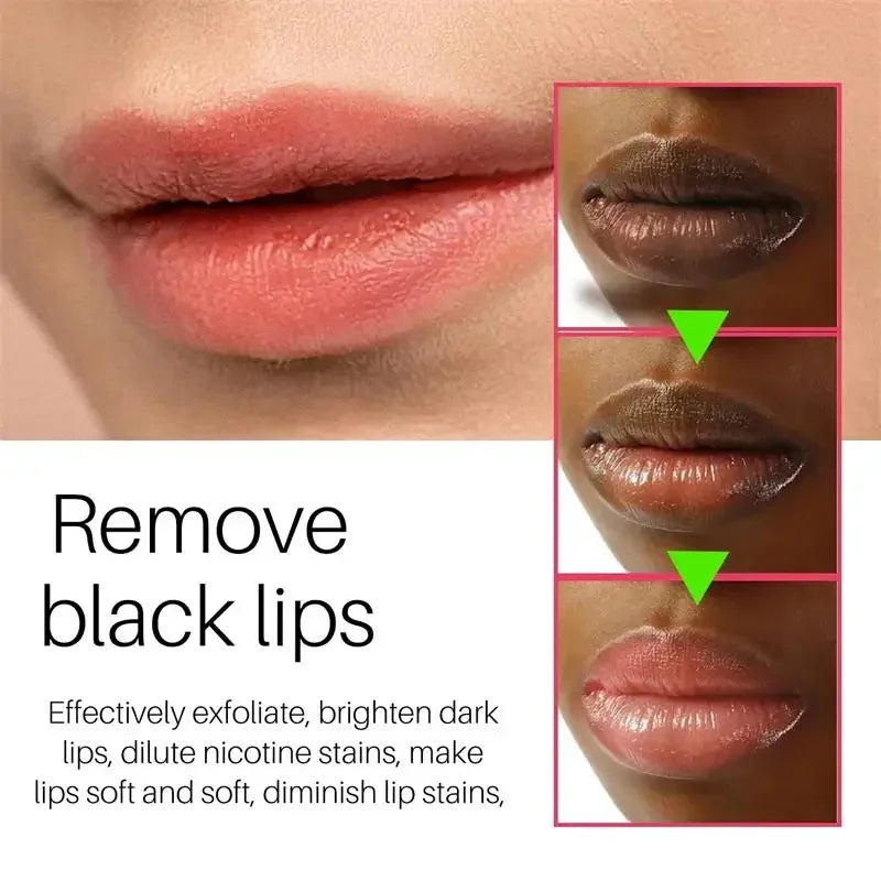 Remove Dark Lip Balm Fast Lightening Pink Lip Exfoliating Fade Lip Line Dead Skin Moisturizer Korean Care Products Beauty Health Tri Light Beauty