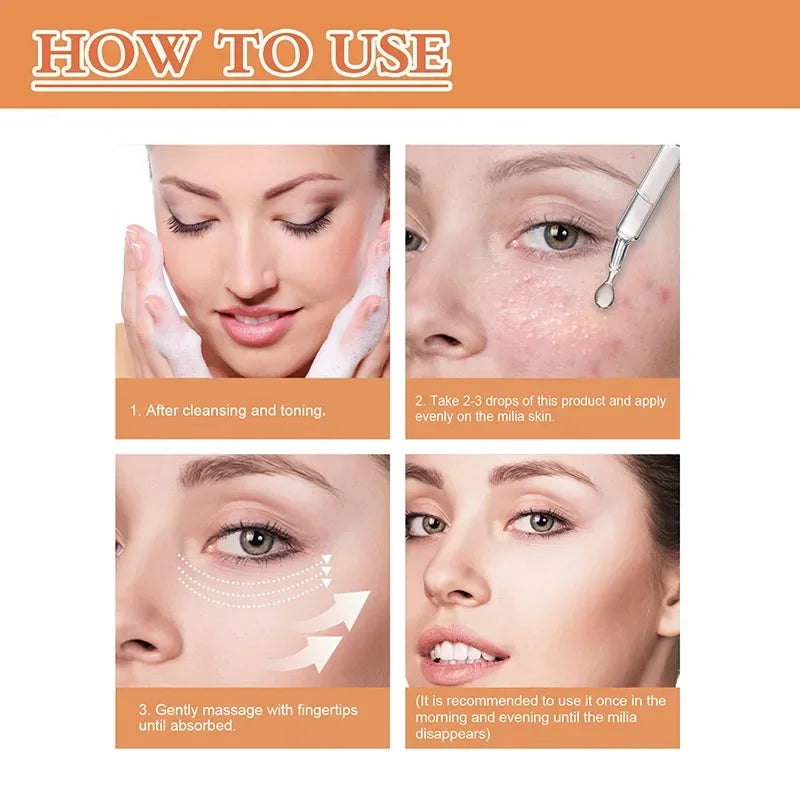 Fat Granules Removal Eye Serum Eye Milia Repair Treatment Products Wrinkle Lifting Moisturizing Anti-Puffiness Korean Skin Care Pi-Mart