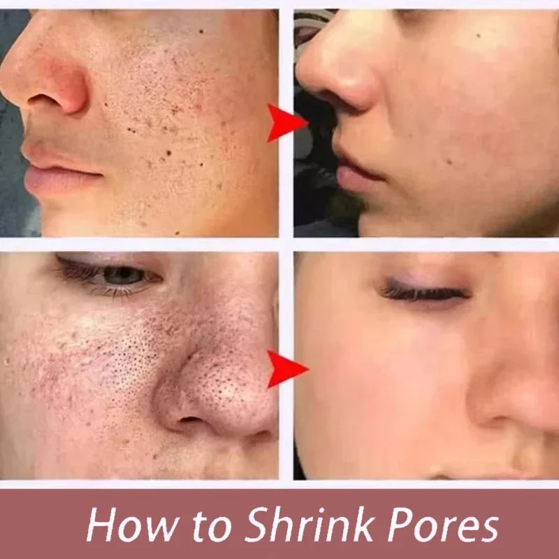 Remove Large Pores Serum Salicylic Acid Facial Pore Shrinking Tightening Pore Minimizing Firming Smooth Essence Korean Skin Care Pi-Mart