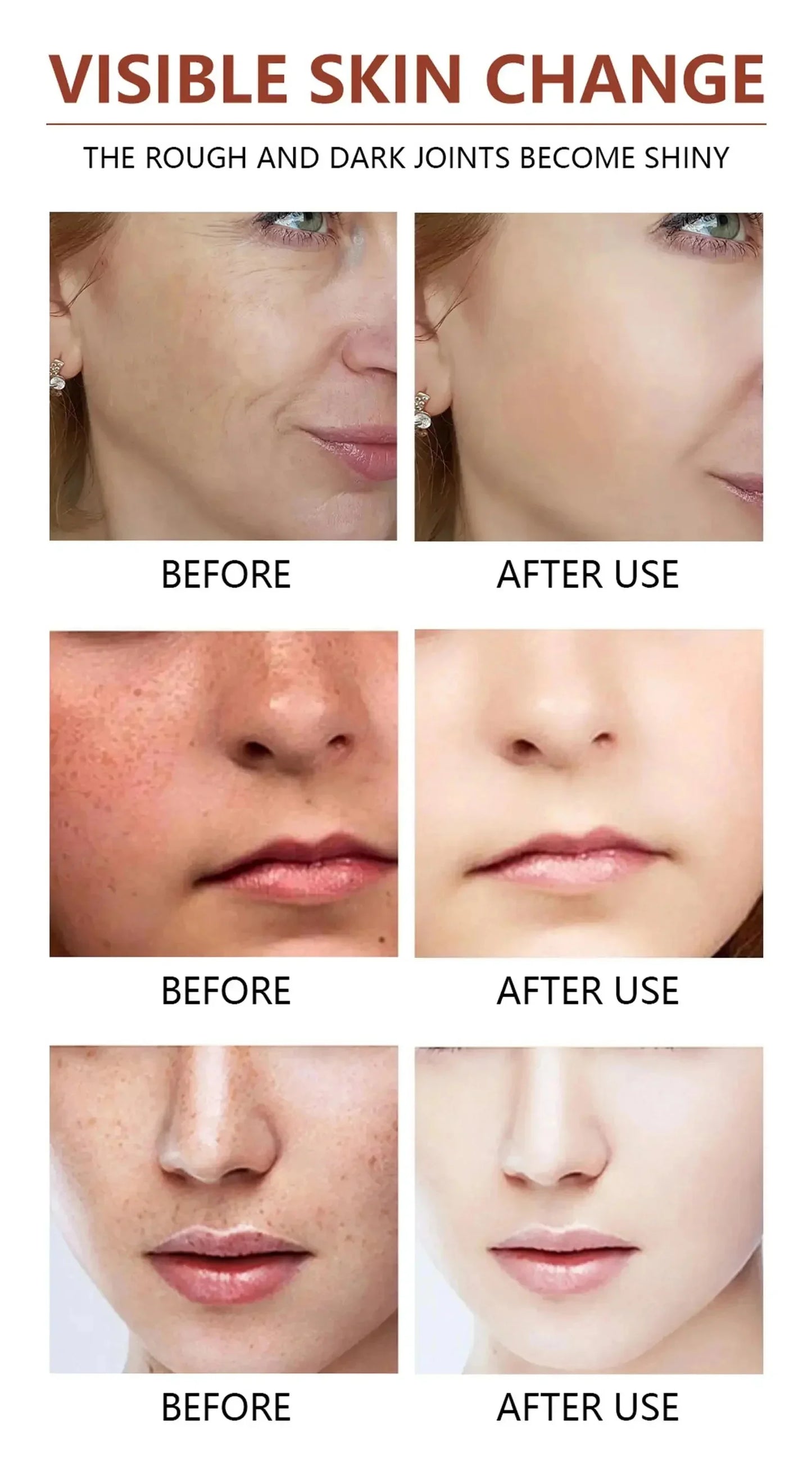 Acid Peeling Serum Chemical Exfoliant Peel For Remove Face Dark Skin Spots Whiten Lighten Melanin Peeling Solution Skin Peel Pi-Mart