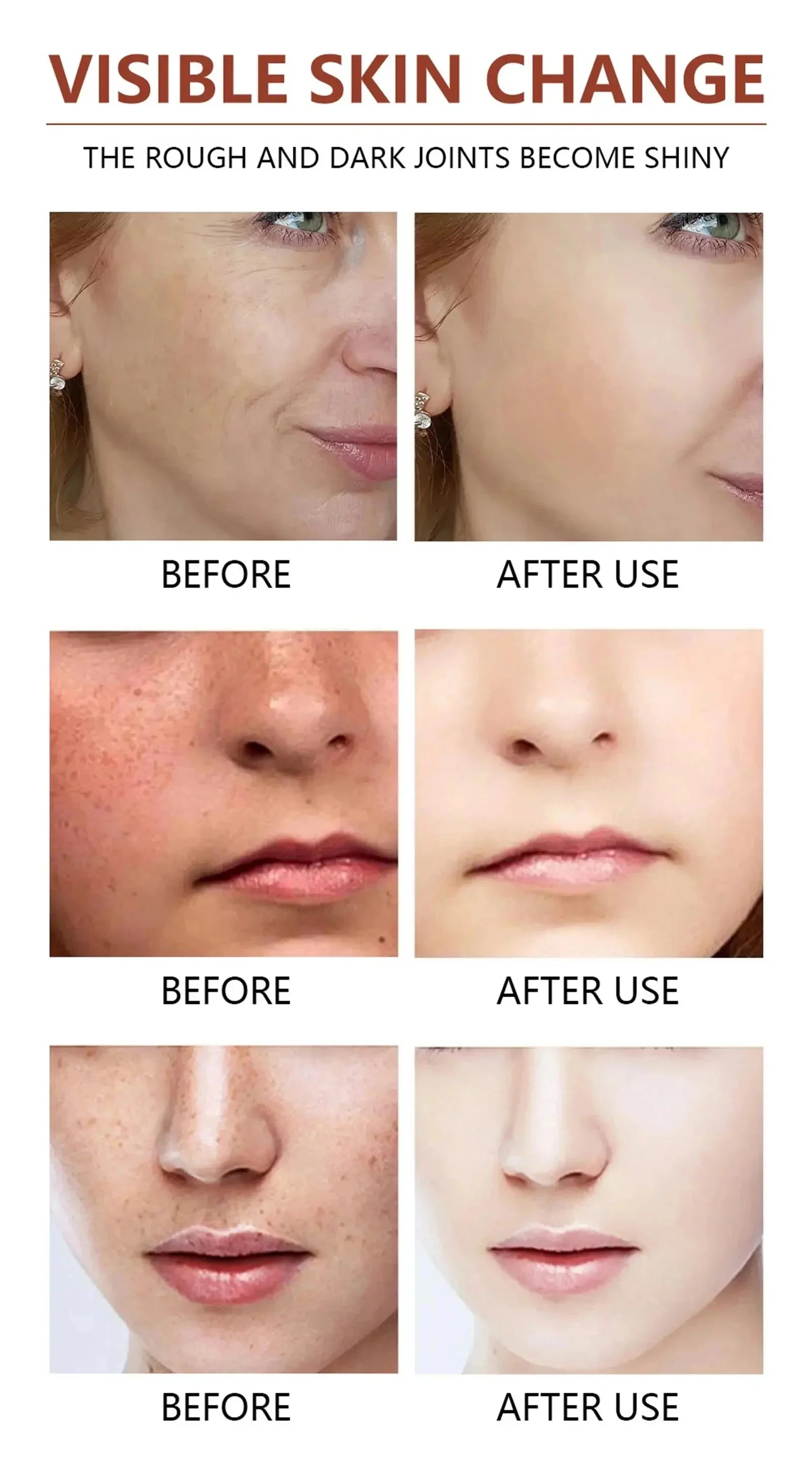 Acid Peeling Serum Chemical Exfoliant Peel For Remove Face Dark Skin Spots Whiten Lighten Melanin Peeling Solution Skin Peel Pi-Mart
