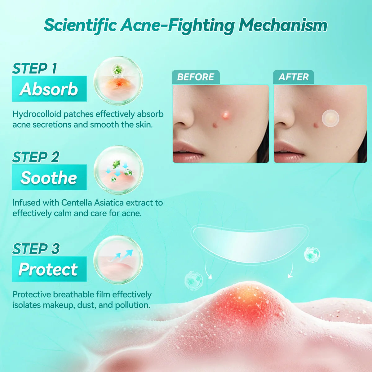 LANBENA Acne Pimple Patch Daily Use and Night Use Invisible Acne Stickers Blemish Treatment Acne Concealer Makeup Pi-Mart