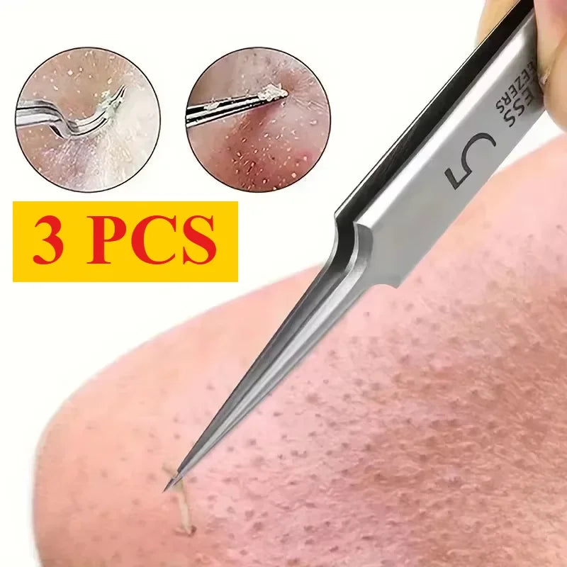 German 1/3/8Pack Extra Fine No. 5 Cellular Acne Blackhead Tweezers - Facial Beauty Remove Acne Needle Tools for Skin Care Tools Pi-Mart