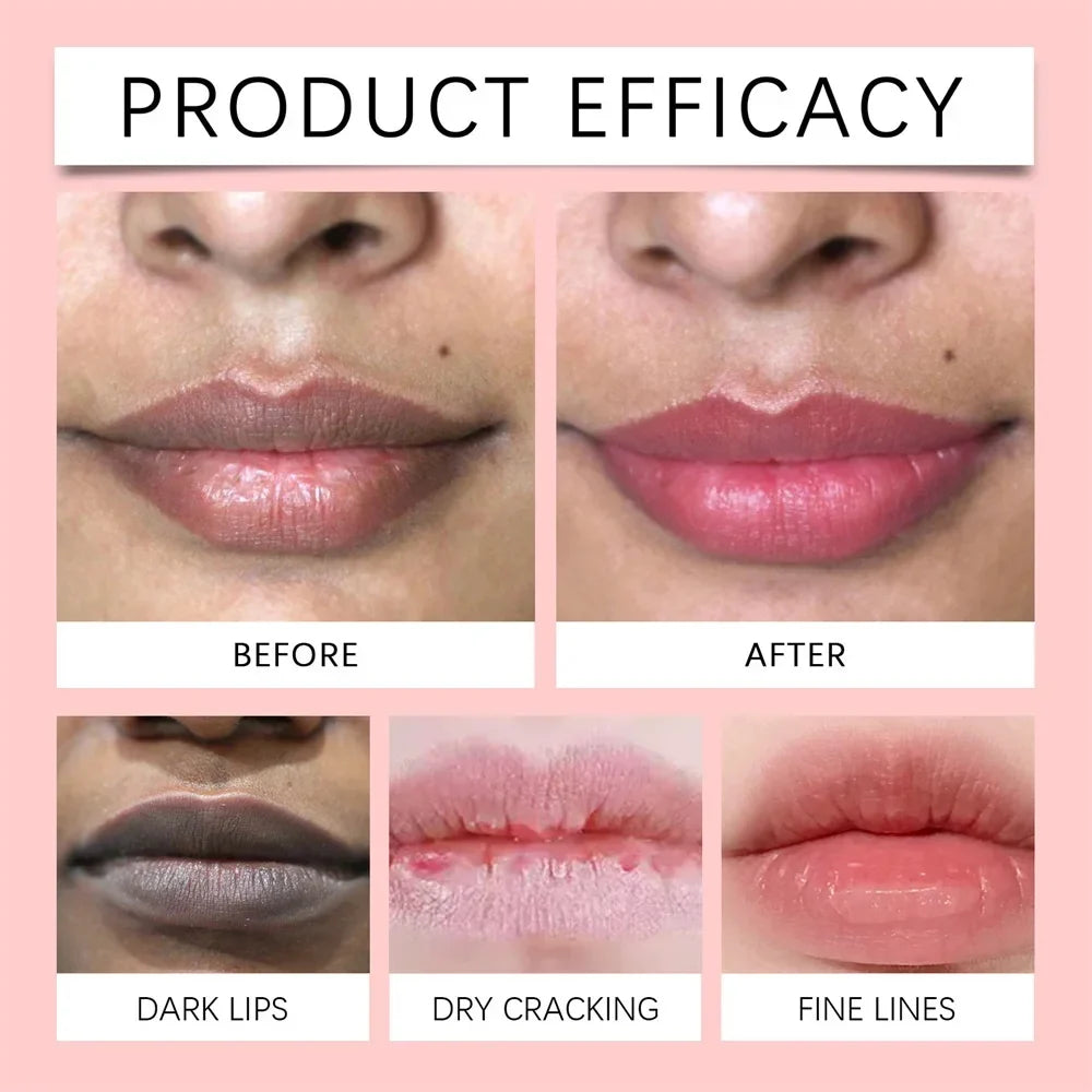 Remove Dark Lip Balm Fast Lightening Pink Lip Exfoliating Fade Lip Line Dead Skin Moisturizer Korean Care Products Beauty Health Tri Light Beauty