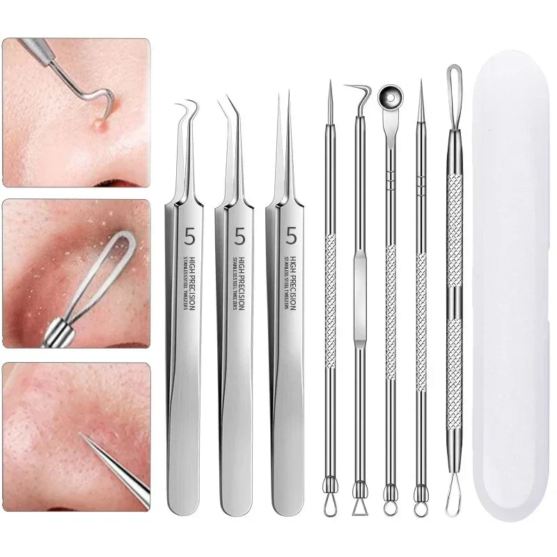 3-8Pcs Blackhead Clip Pimples Tweezer Blackhead Remover Stainless Steel Cell Clip Beauty Product Acne Needle Skin Cleanning Tool Tri Light Beauty