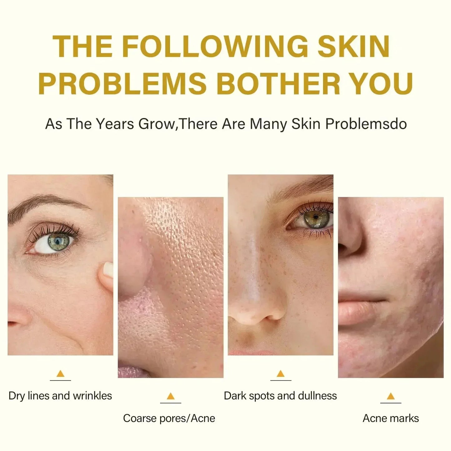Acid Peeling Serum Chemical Exfoliant Peel For Remove Face Dark Skin Spots Whiten Lighten Melanin Peeling Solution Skin Peel Pi-Mart