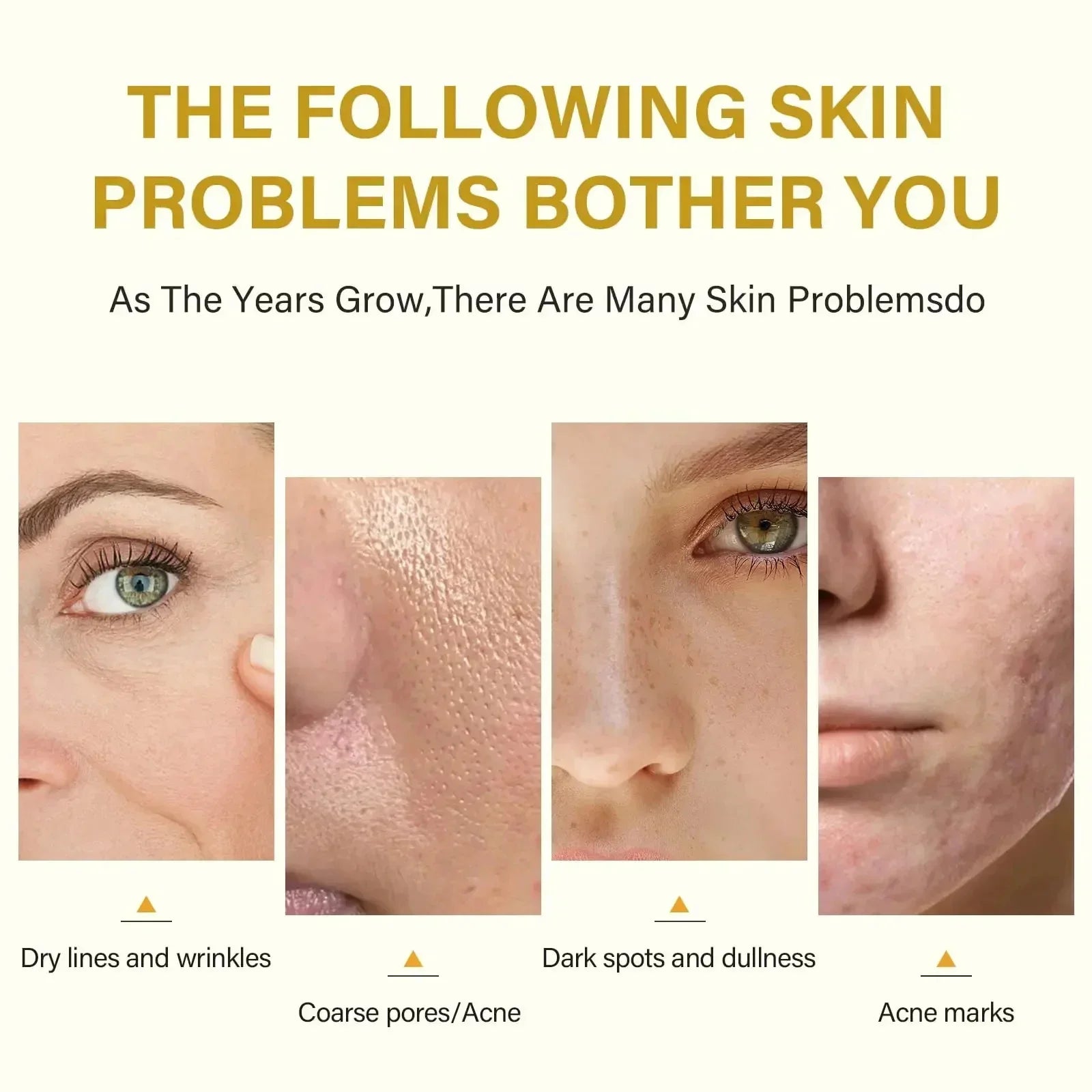 Acid Peeling Serum Chemical Exfoliant Peel For Remove Face Dark Skin Spots Whiten Lighten Melanin Peeling Solution Skin Peel Pi-Mart