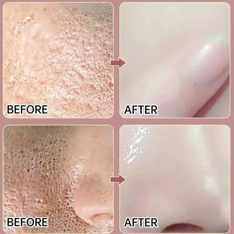Remove Large Pores Serum Salicylic Acid Facial Pore Shrinking Tightening Pore Minimizing Firming Smooth Essence Korean Skin Care Pi-Mart
