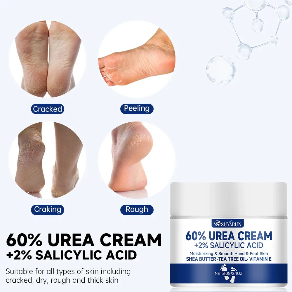 SUYARUN 60% Urea Foot Cream for Cracked Heels & Dry Skin - Intensive Moisturizing Treatment, Callus Remover, Diabetic Foot Care. Tri Light Beauty