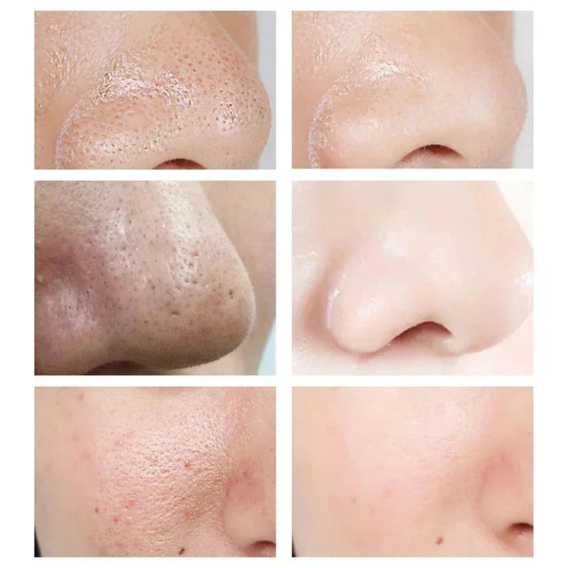 Remove Large Pores Serum Salicylic Acid Facial Pore Shrinking Tightening Pore Minimizing Firming Smooth Essence Korean Skin Care Pi-Mart
