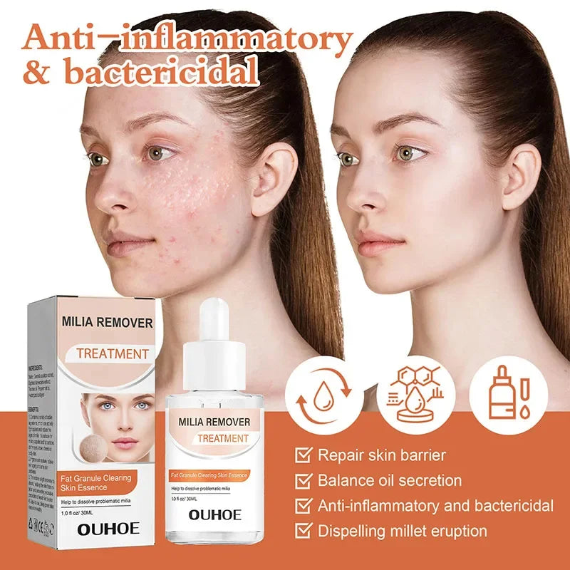 Fat Granules Removal Eye Serum Eye Milia Repair Treatment Products Wrinkle Lifting Moisturizing Anti-Puffiness Korean Skin Care Pi-Mart