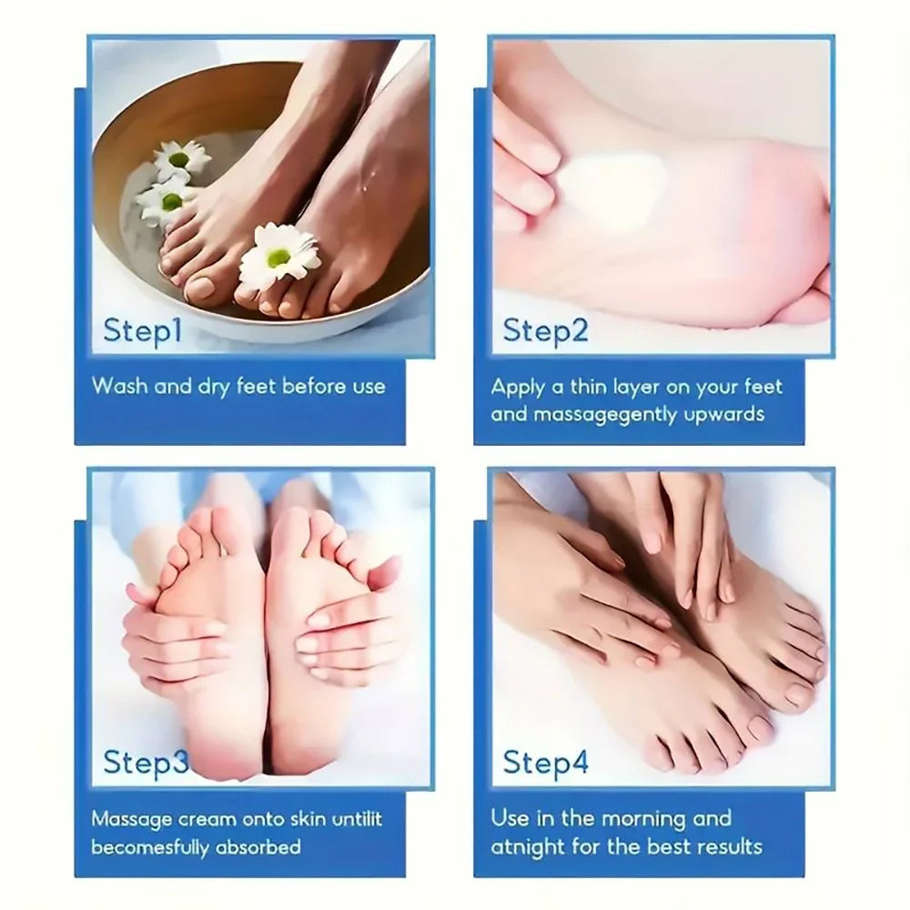 SUYARUN 60% Urea Foot Cream for Cracked Heels & Dry Skin - Intensive Moisturizing Treatment, Callus Remover, Diabetic Foot Care. Tri Light Beauty