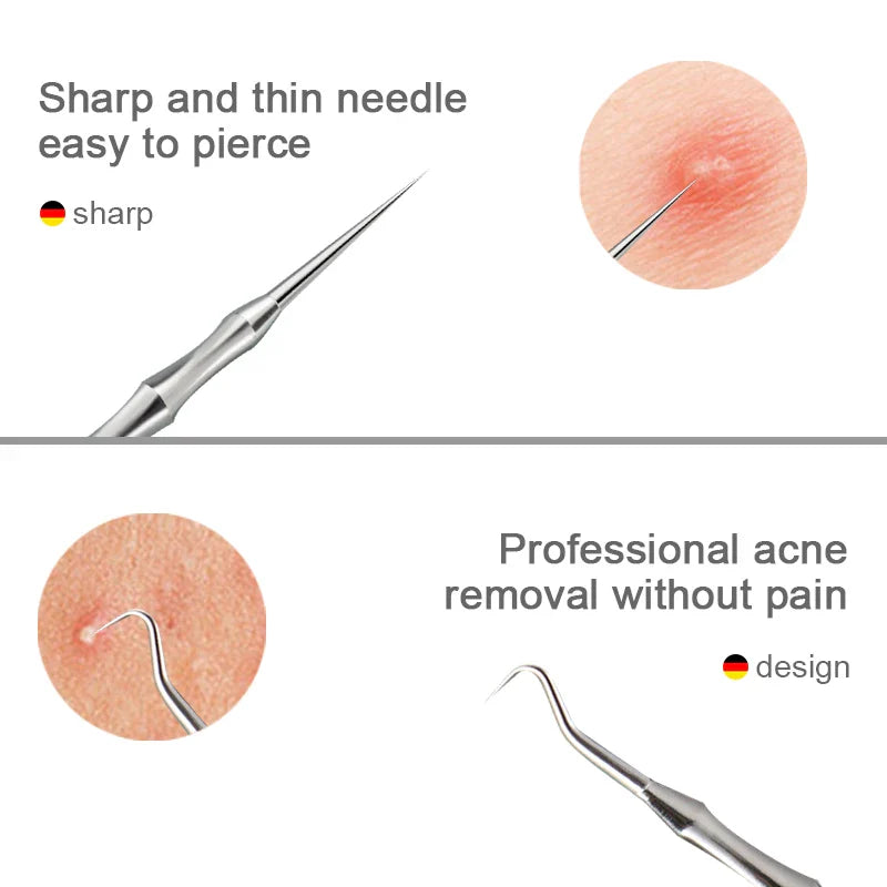 New German Acne Blackhead Removal Needles Pimples Blackhead Clip Tweezers Beauty Artifact Blemish Extractor Remover Needle Tool Tri Light Beauty