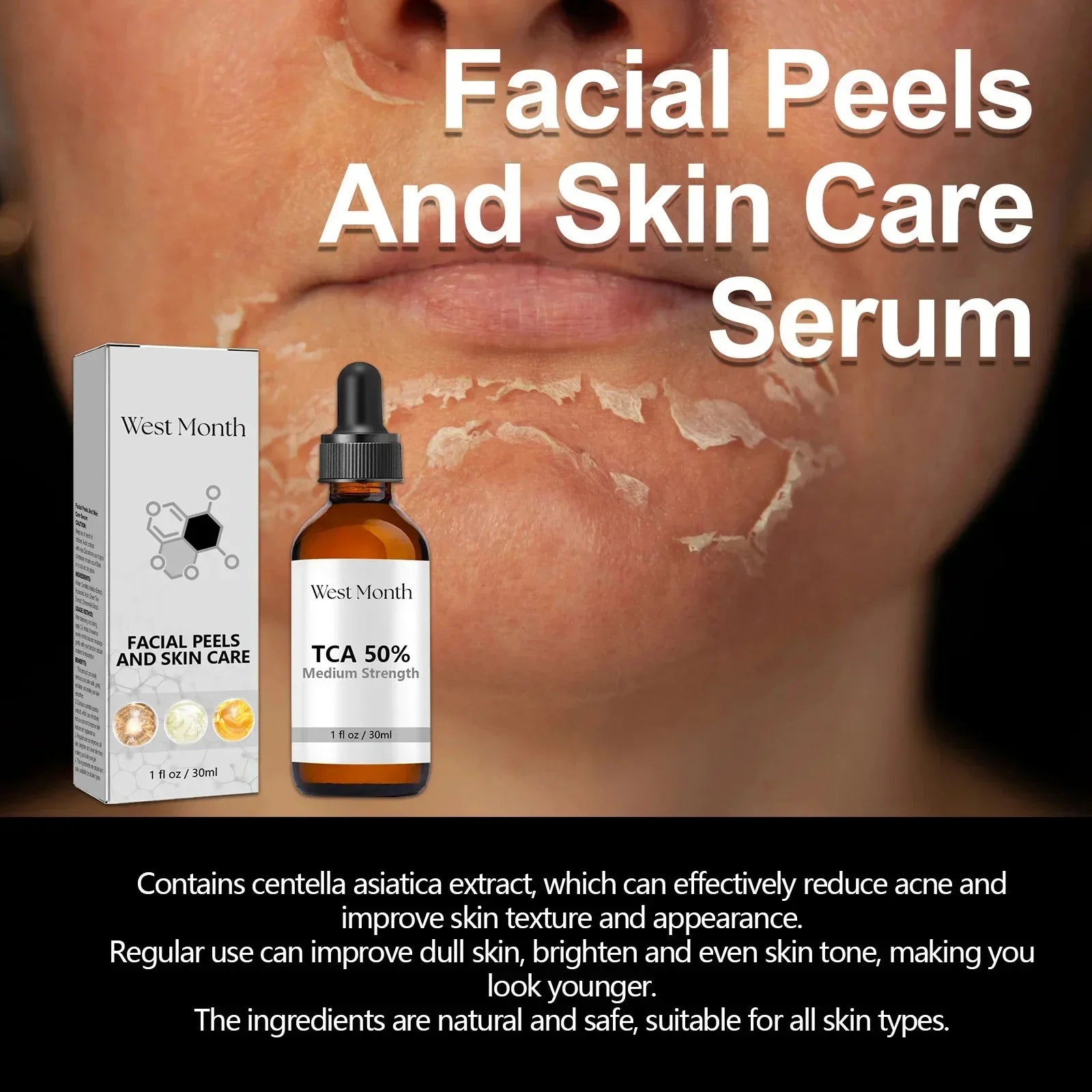 Acid Peeling Serum Chemical Exfoliant Peel For Remove Face Dark Skin Spots Whiten Lighten Melanin Peeling Solution Skin Peel Pi-Mart
