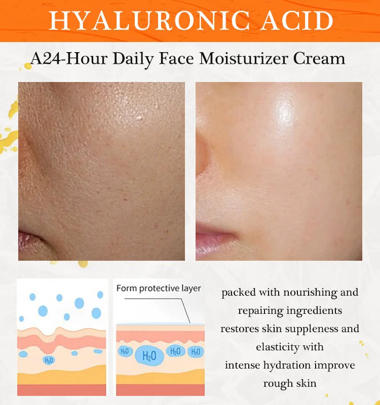 JoyPretty Vitamin C Face Cream Whitening Hyaluronic Acid Moisturizing Dark Spot Remover Brightening Facial Cream Skin Care 50g Pi-Mart