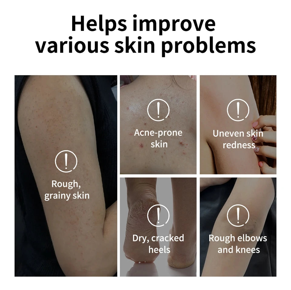 Glycolic Acid Exfoliating Body Stick Multiple Concerns Delivers Deep Effective Exfoliation Nourishing Moisture Deep Hydration Pi-Mart