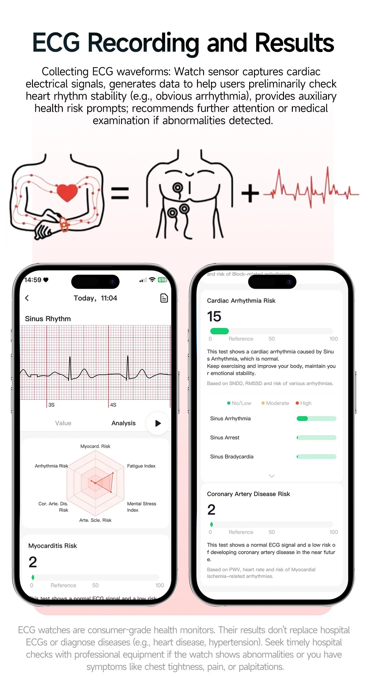 New Men Accurate Health Diagnosis ECG Smart Watch Blood Pressure Blood Oxygen Blood Fat Uric Acid Temp Bluetooth call Smartwatch Pi-Mart