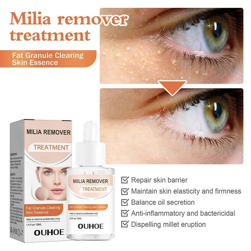 Fat Granules Removal Eye Serum Eye Milia Repair Treatment Products Wrinkle Lifting Moisturizing Anti-Puffiness Korean Skin Care Pi-Mart