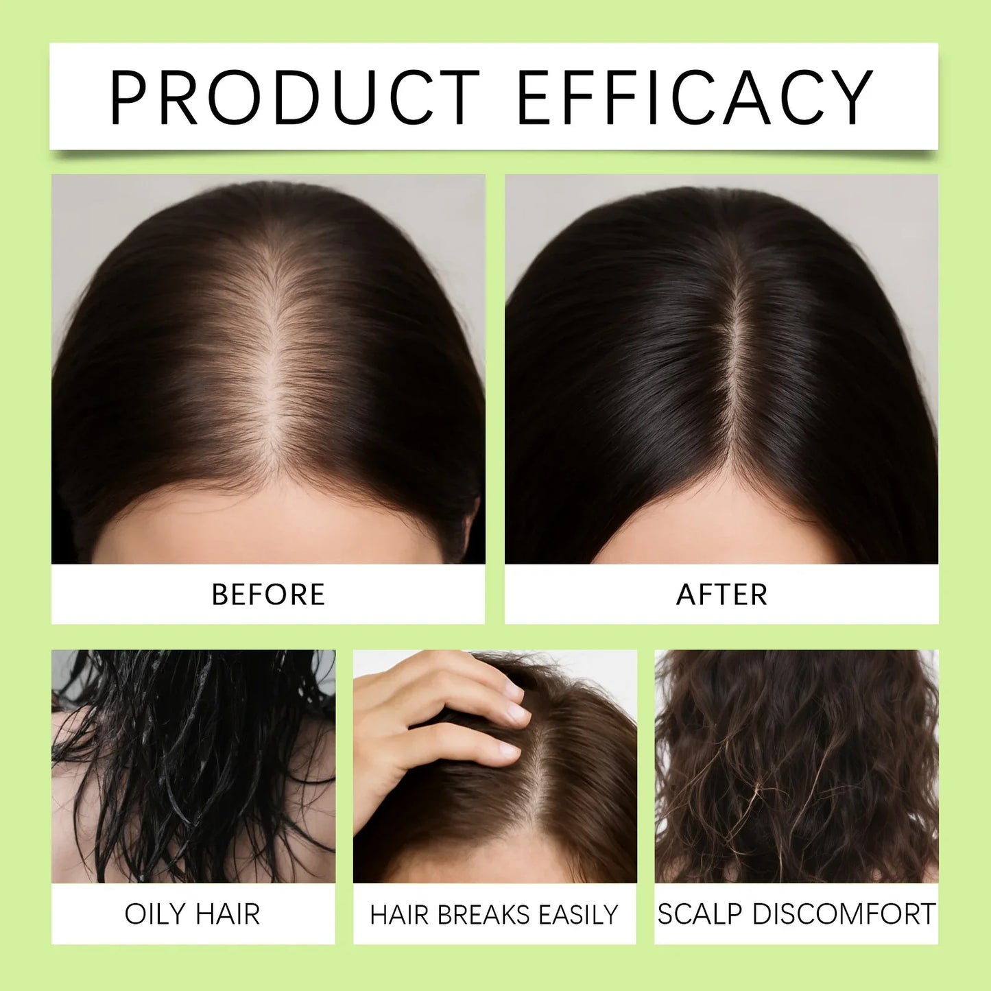 Anti-Hair Loss Scalp Care Roller Serum Kit Nourishes Roots Strengthens Hair Prevents Baldness Daily Care Pi-Mart