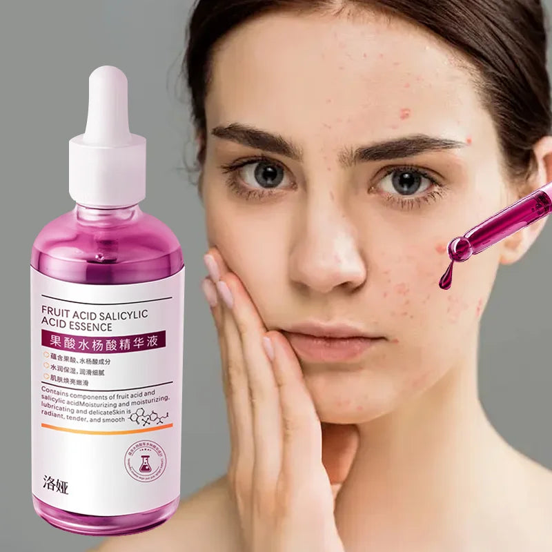 100ml Pink Salicylic Acid Acne Removing Concentrated essence - Refreshing texture, deep moisturizing, fade acne marks Pi-Mart