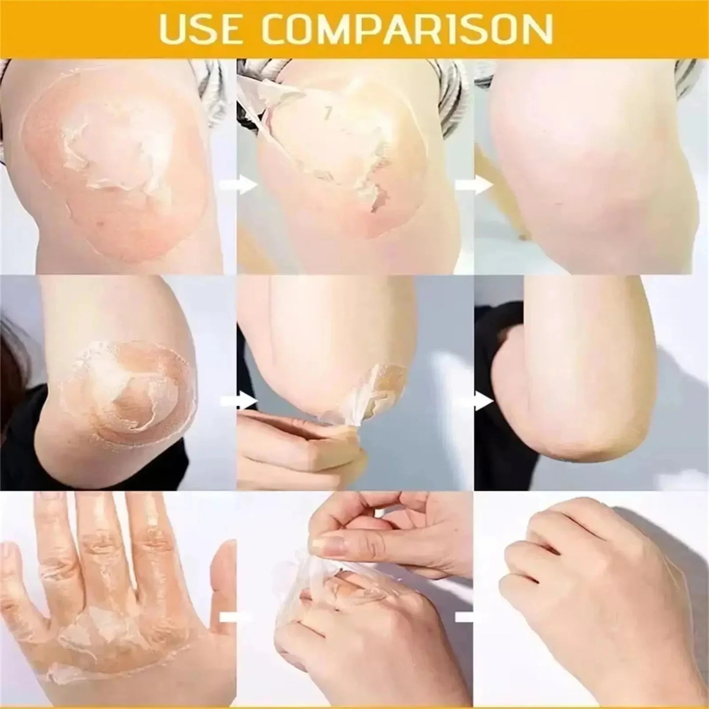 Acid Peeling Serum Chemical Exfoliant Peel For Remove Face Dark Skin Spots Whiten Lighten Melanin Peeling Solution Skin Peel Pi-Mart