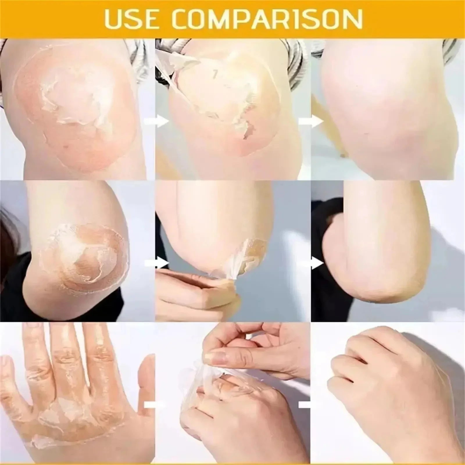 Acid Peeling Serum Chemical Exfoliant Peel For Remove Face Dark Skin Spots Whiten Lighten Melanin Peeling Solution Skin Peel Pi-Mart