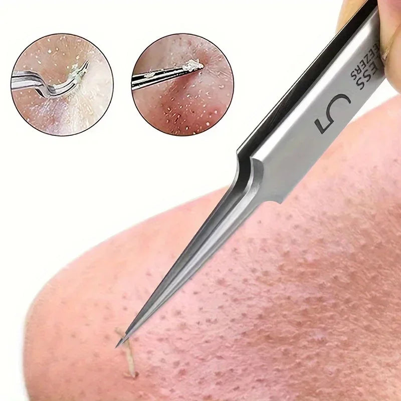 German 1/3/8Pack Extra Fine No. 5 Cellular Acne Blackhead Tweezers - Facial Beauty Remove Acne Needle Tools for Skin Care Tools Pi-Mart