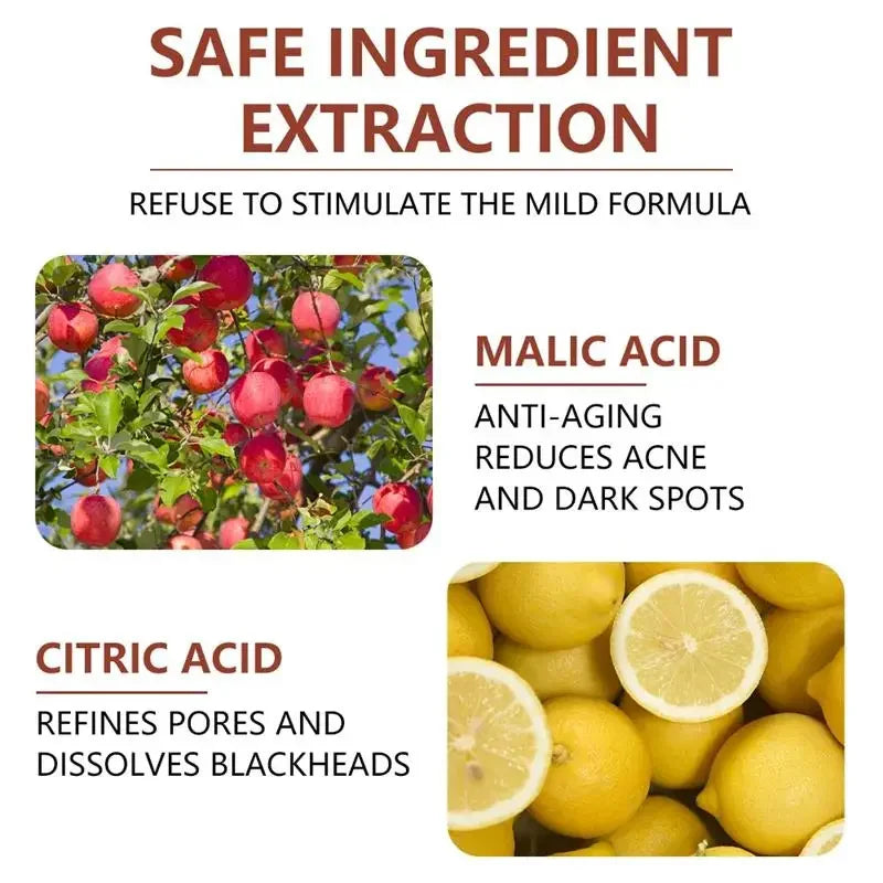Acid Peeling Serum Chemical Exfoliant Peel For Remove Face Dark Skin Spots Whiten Lighten Melanin Peeling Solution Skin Peel Pi-Mart