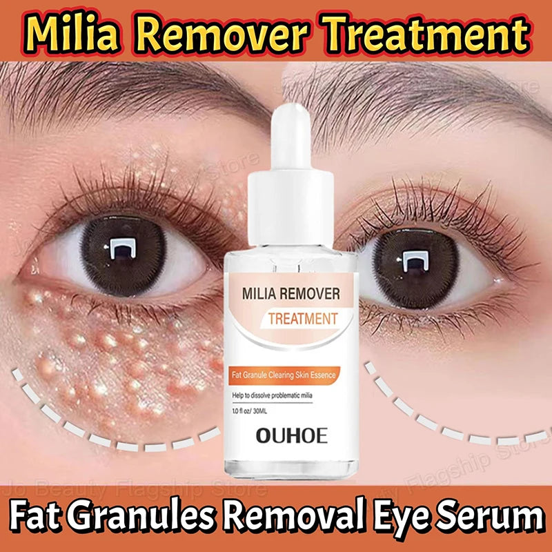 Fat Granules Removal Eye Serum Eye Milia Repair Treatment Products Wrinkle Lifting Moisturizing Anti-Puffiness Korean Skin Care Pi-Mart