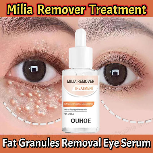 Fat Granules Removal Eye Serum Eye Milia Repair Treatment Products Wrinkle Lifting Moisturizing Anti-Puffiness Korean Skin Care Pi-Mart