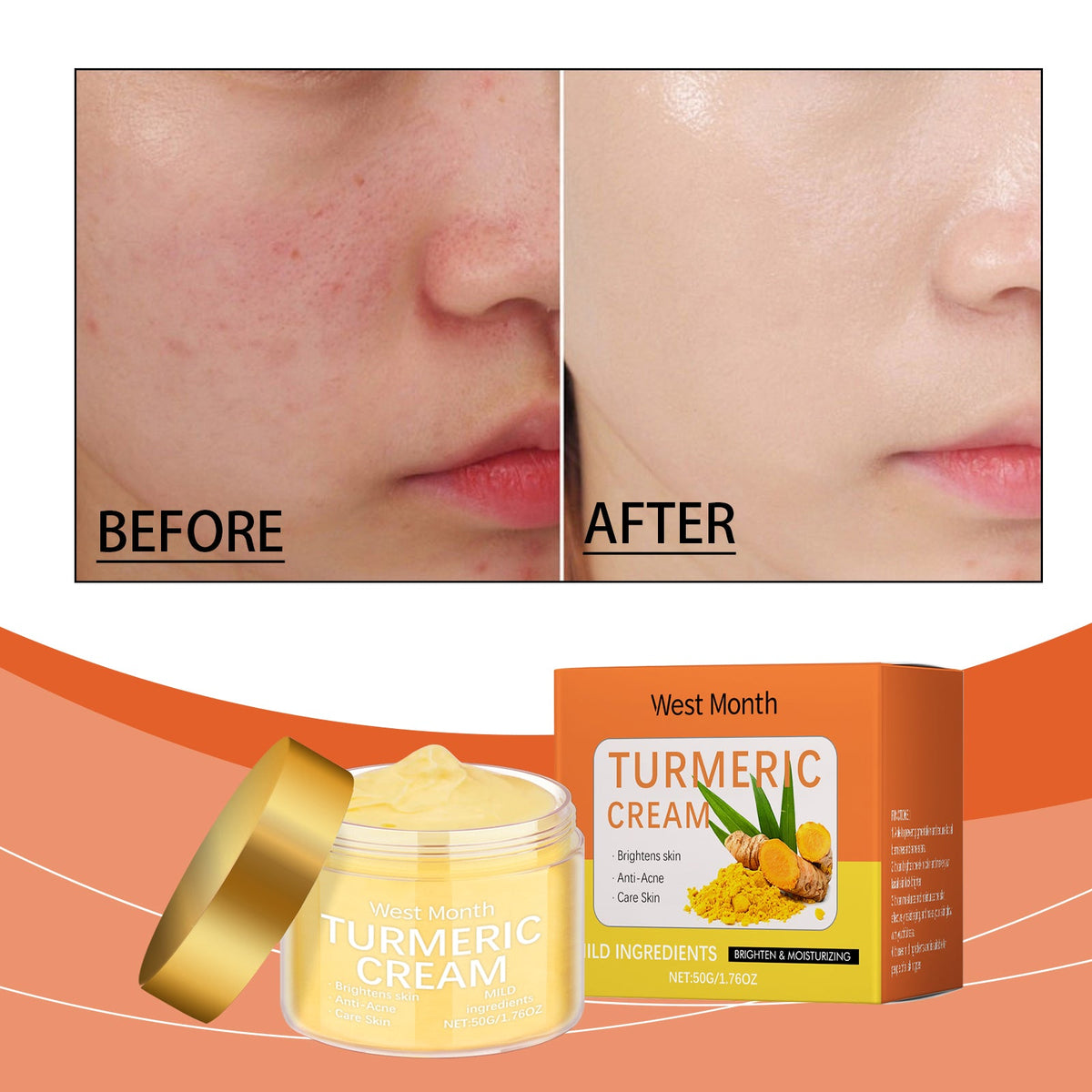 Turmeric Moisturizing Cream Brightens Skin, Fights Acne, Nourishes And Hydrates, Suitable For All Skin Types. Tri Light Beauty