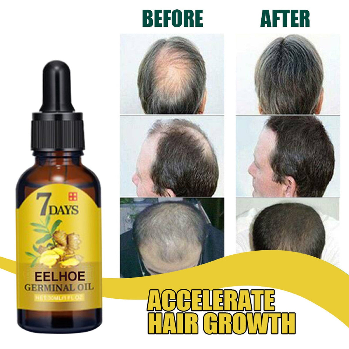Ginger Hair Liquid 20ml 1box Tri Light Beauty