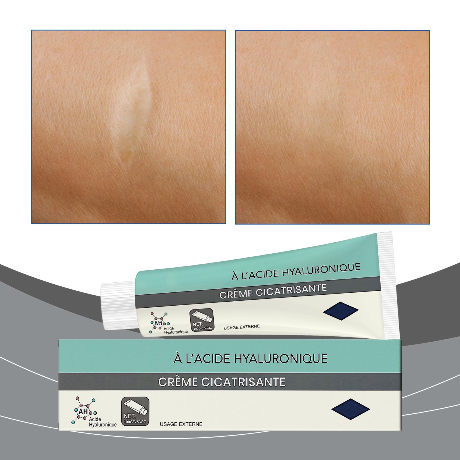 Skin Lightening & Soothing Cream Tri Light Beauty