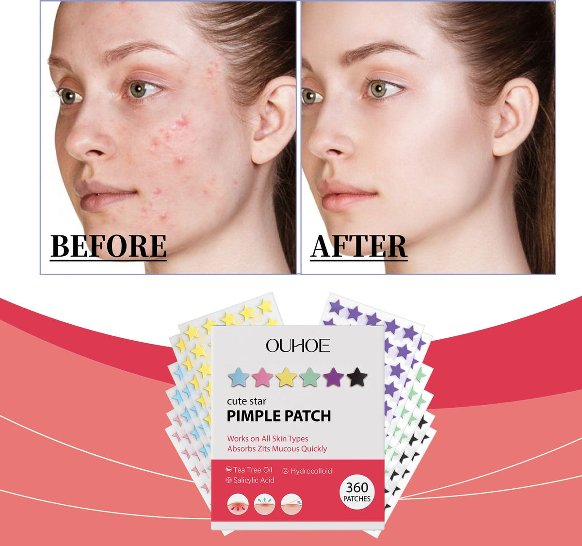 Daily Gentle Cleaning And Skin Concealer Star Shaped Gel Facial Acne Patch 360 Pcs 1 Box Tri Light Beauty