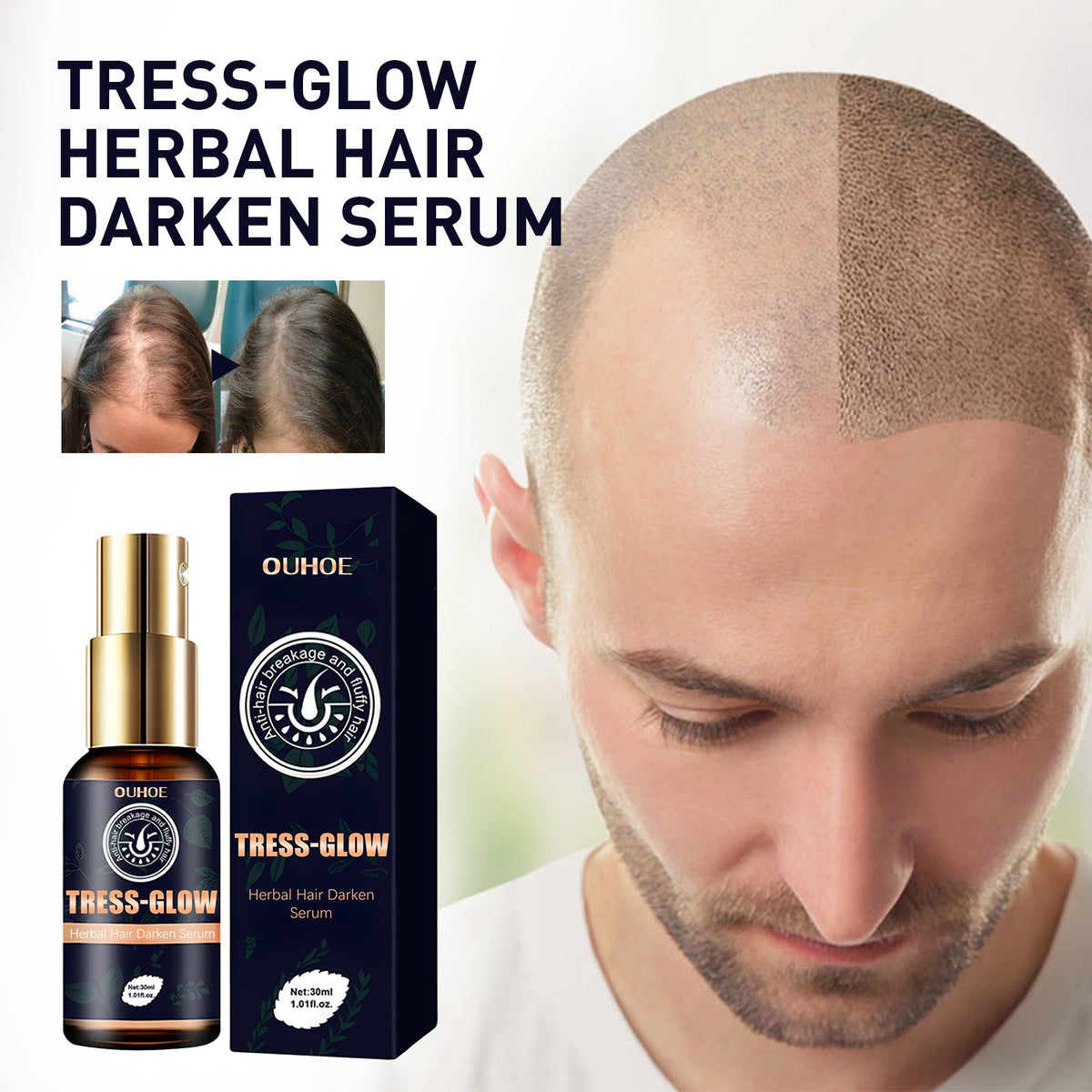 Gentle Moisturizing Scalp, Gentle Massage, Care For Beard, Gloss Care, E Ssence, Herbal Strong Hair Root E Ssence Oil, 30ml, 1 Box Tri Light Beauty