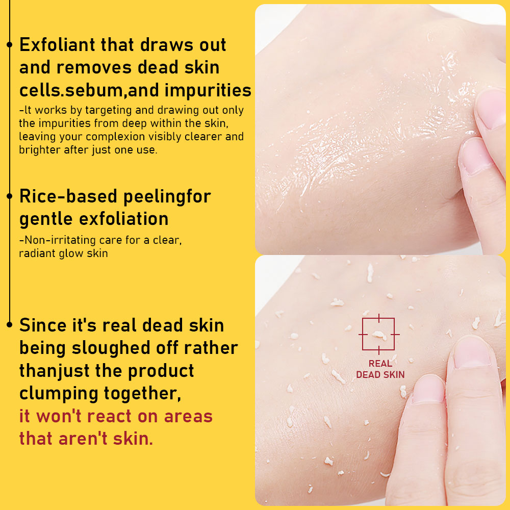 PHOFAY GENTLE PEELING SOLUTION PAPAYA ENZYME AHA BHA LadyShow.Store
