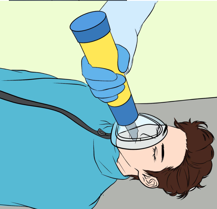 Choking Emergency Device Pi-Mart