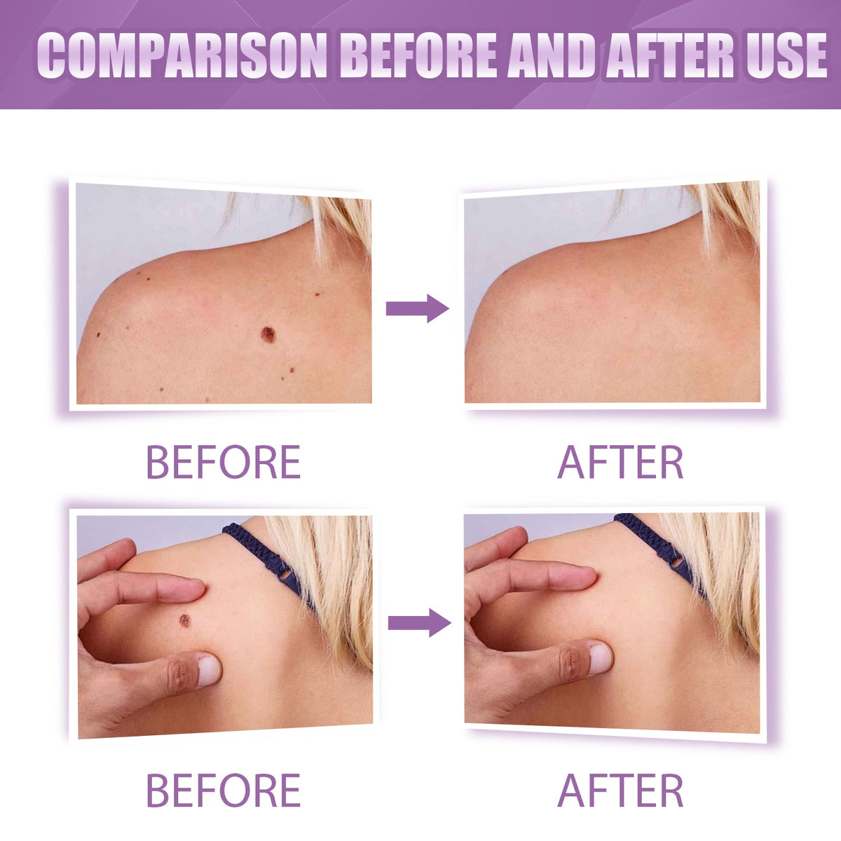 Skin Care Pen 3ml 1box Tri Light Beauty