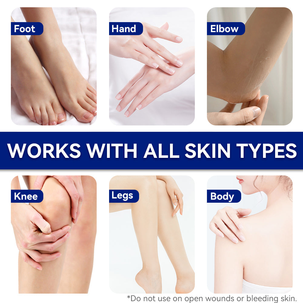ETEB Urea Cream Moisturizing Vitamin E Cream Body Lotion Hand And Foot Care For Dry Hands And Feet Tri Light Beauty