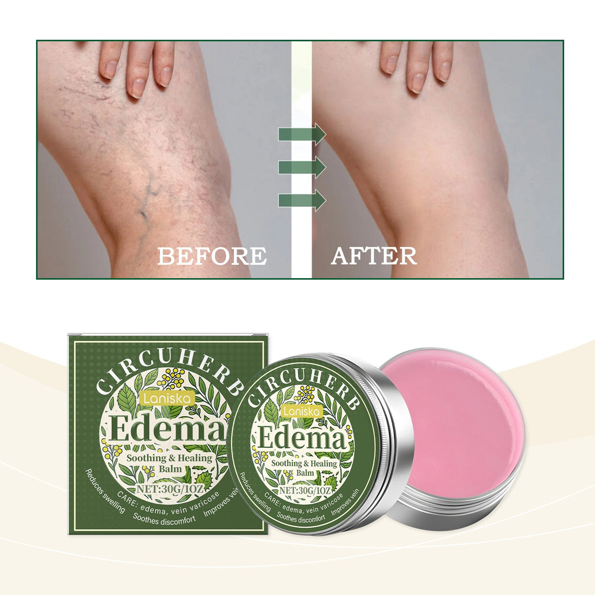 Edema Soothing Repair Cream 30g-box Tri Light Beauty