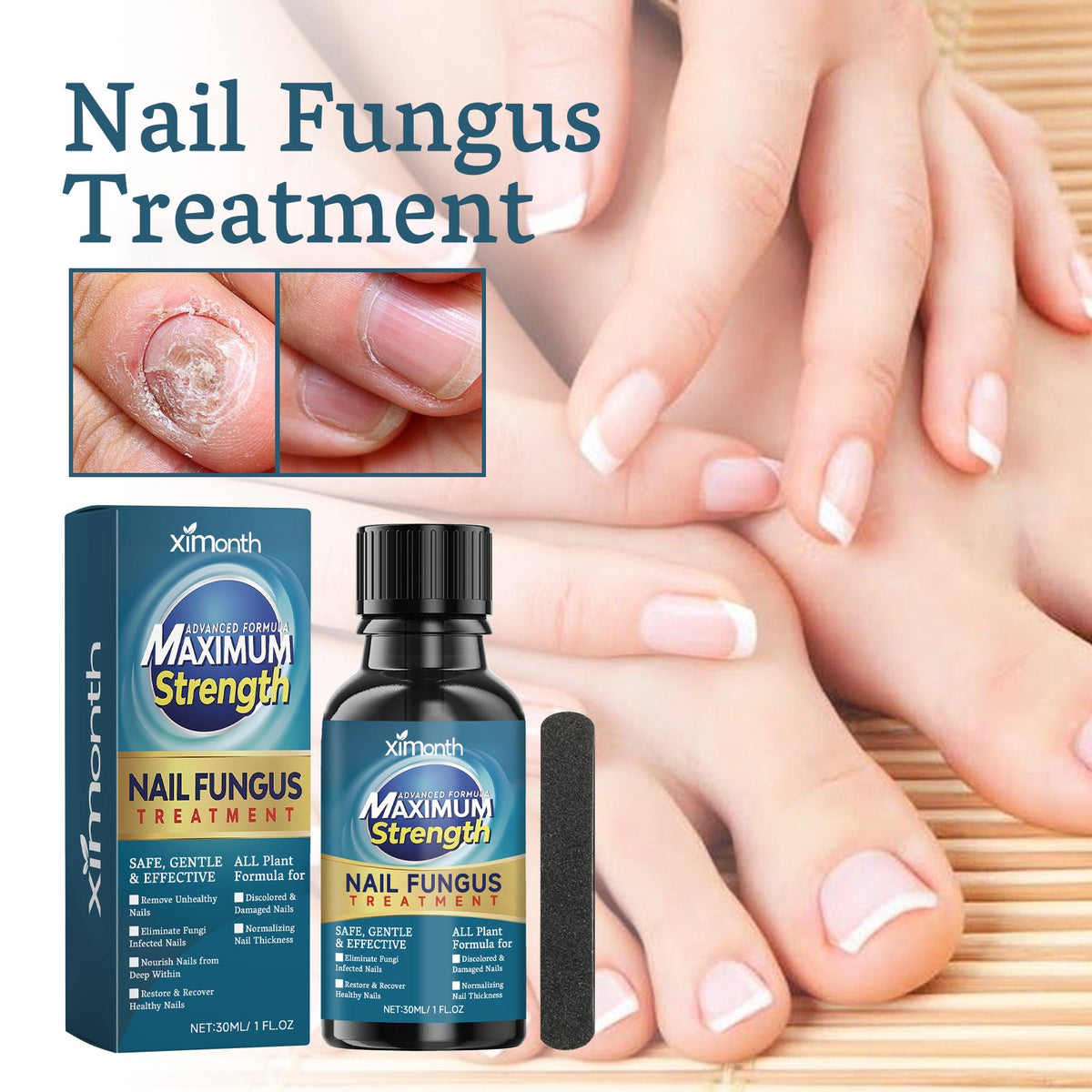 Nail Embedding Thickened Bright Nail Grey Nail Soft Nail Hand Foot Nail Care Liquid Nail Care Liquid 30 Bottles-1 Scraper Box Tri Light Beauty