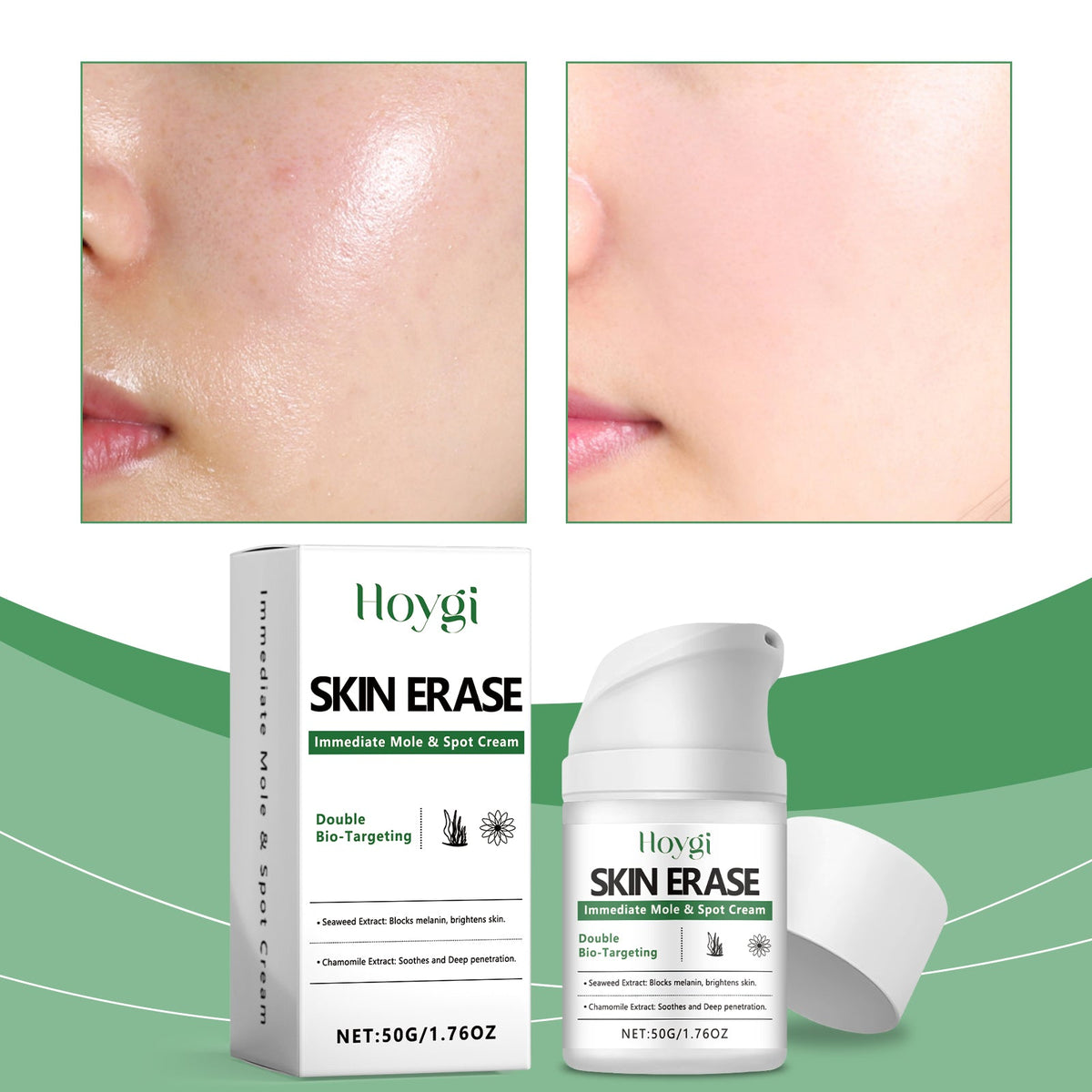Brightening And Spot Whitening Moisturizing Cream Tri Light Beauty
